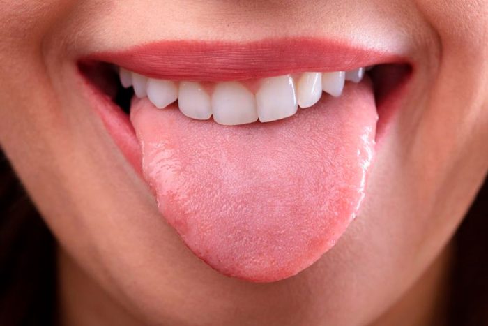 Como Limpiar La Lengua Cl Nica Dental Druiz Dentista En Burgos