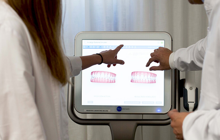 escaner-intraoral-ortodoncia-invisible