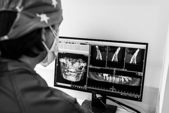 Implantes Dentales en un día - Burgos - Clínica Dental Druiz